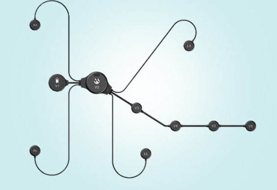 实时心电监测的意义在哪？有哪些产品可选？